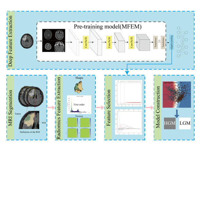 🎉 Deep learning and radiomics-based approach to meningioma grading: exploring the potential value of peritumoral edema regions